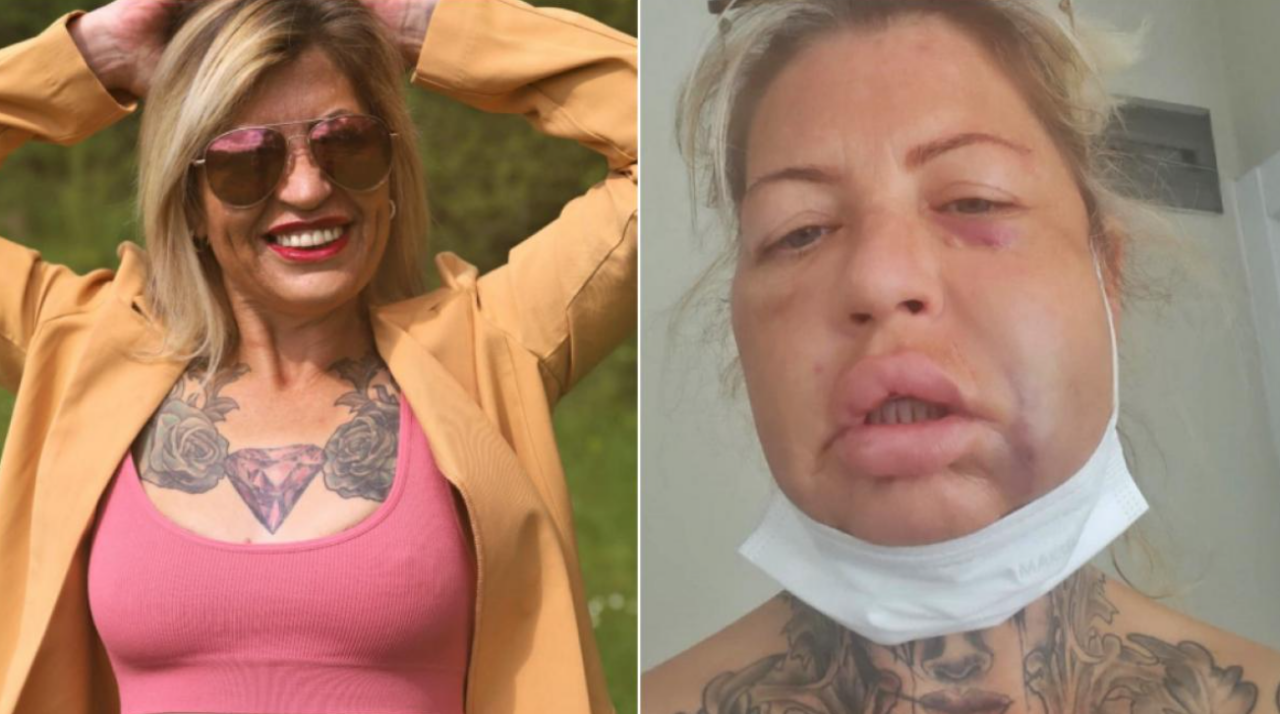 cosmarul-lui-vicky-din-nottingham-cu-ce-zambet-te-poti-pricopsi-cu-doar-10.000-de-lire-sterline