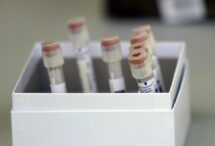 un-test-simplu-de-sange-ar-putea-ajuta-la-depistarea-timpurie-a-bolii-parkinson