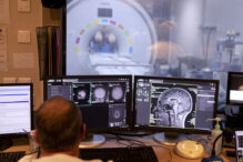 studiu:-anumite-combinatii-de-medicamente-ar-putea-incetini-evolutia-alzheimerului