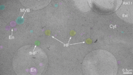 descoperire-revolutionara.-cercetatorii-au-descoperit-o-parte-nemaivazuta-a-celulei-umane