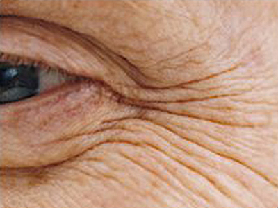 inflamatia-cronica-nu-este-legata-in-mod-explicit-de-imbatranire-–-studiu