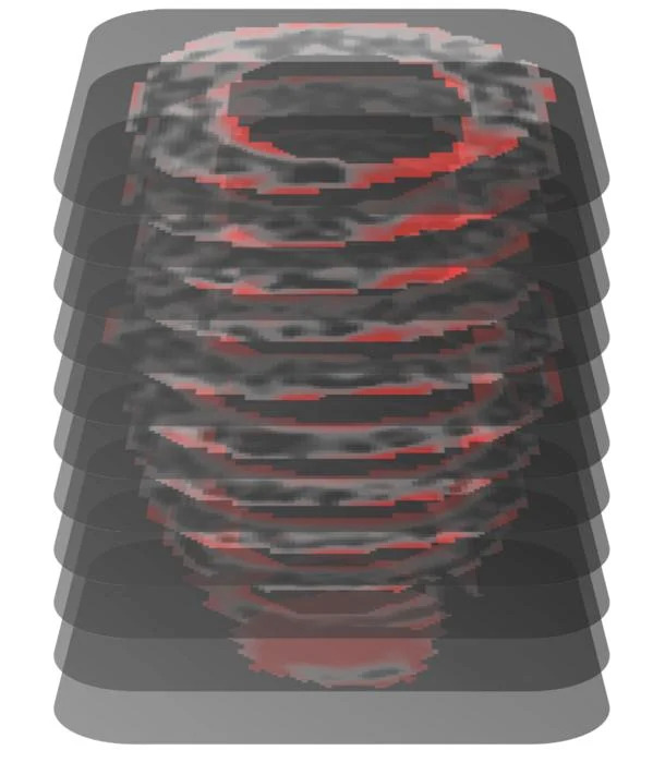 un-nou-algoritm-ai-poate-anticipa-moartea-subita-cardiaca-cu-o-precizie-de-89%