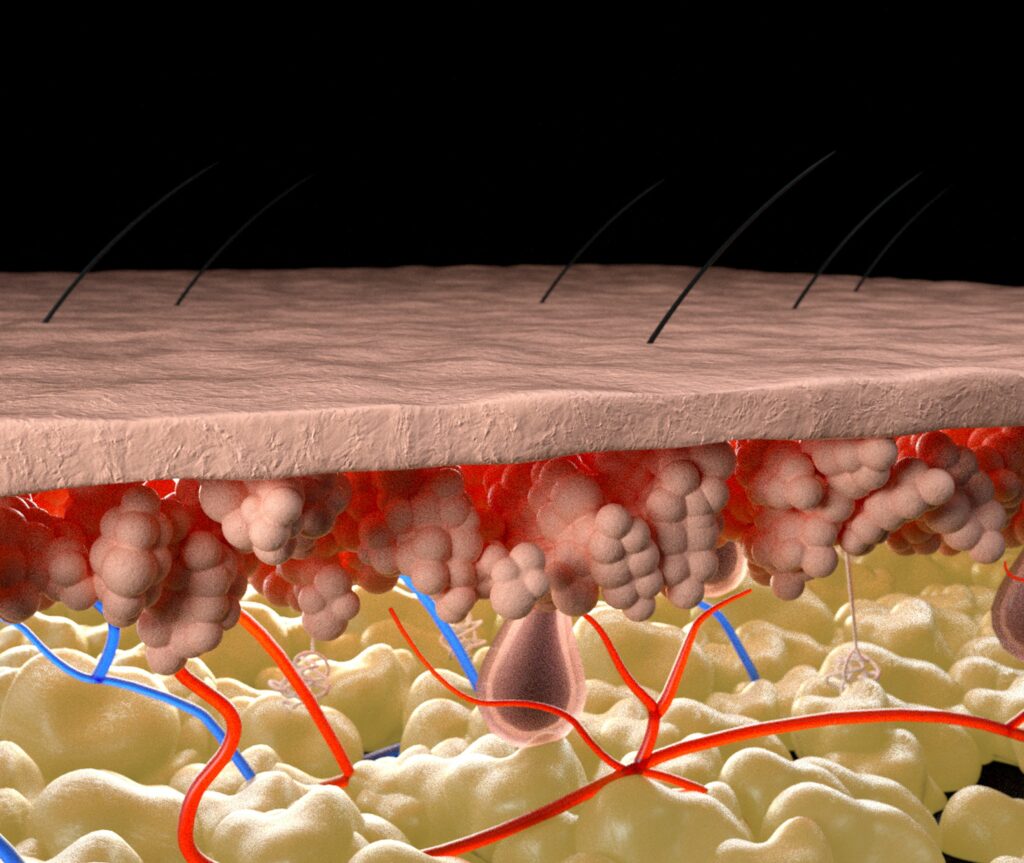 arsurile-solare-nu-inseamna-doar-piele-rosie.-iata-ce-se-intampla-sub-tesutul-ars