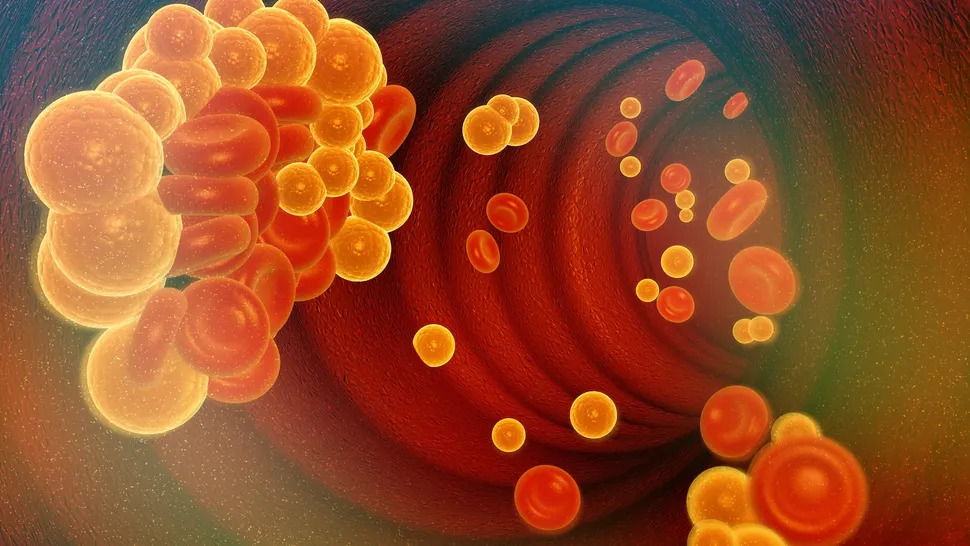 terapia-genetica-verve-102-promite-reducerea-colesterolului-rau