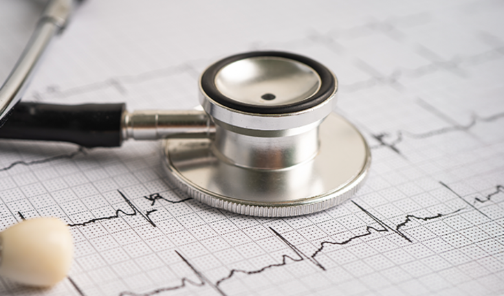 coronarografia:-pachet-de-servicii-medicale-pentru-diagnostic-cardiovascular,-la-arcadia