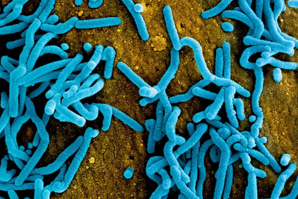 alerta-in-africa:-etiopia-confirma-un-focar-periculos-de-virus-marburg