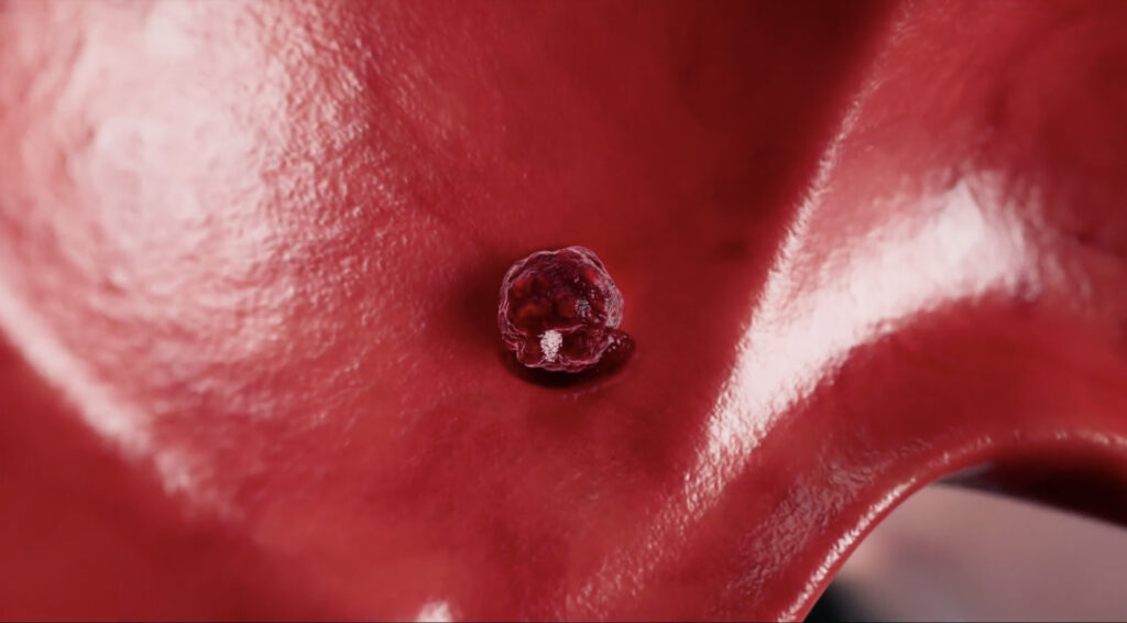 studiu:-munca-de-noapte-creste-riscul-de-cancer