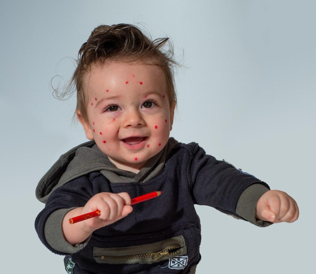 vaccinarea-impotriva-varicelei-devine-obligatorie-in-bulgaria