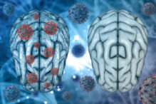 descoperire-soc:-parazitul-cerebral-care-infecteaza-miliarde-de-oameni-nu-doarme