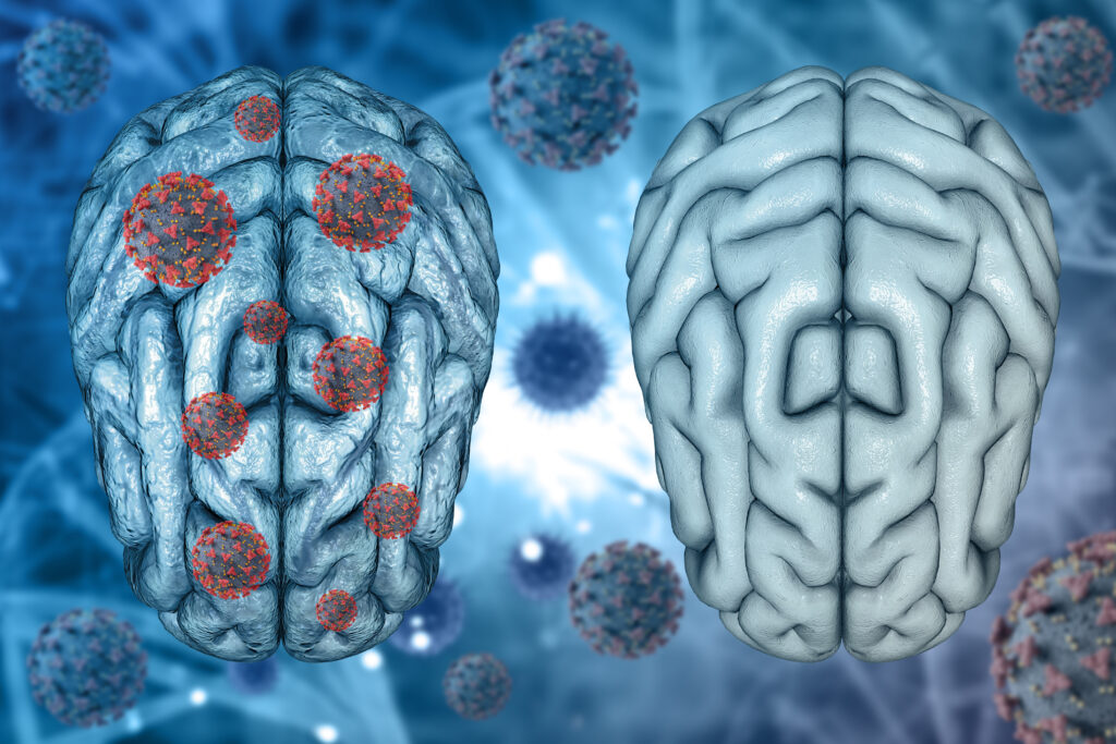 descoperire-soc:-parazitul-cerebral-care-infecteaza-miliarde-de-oameni-nu-doarme