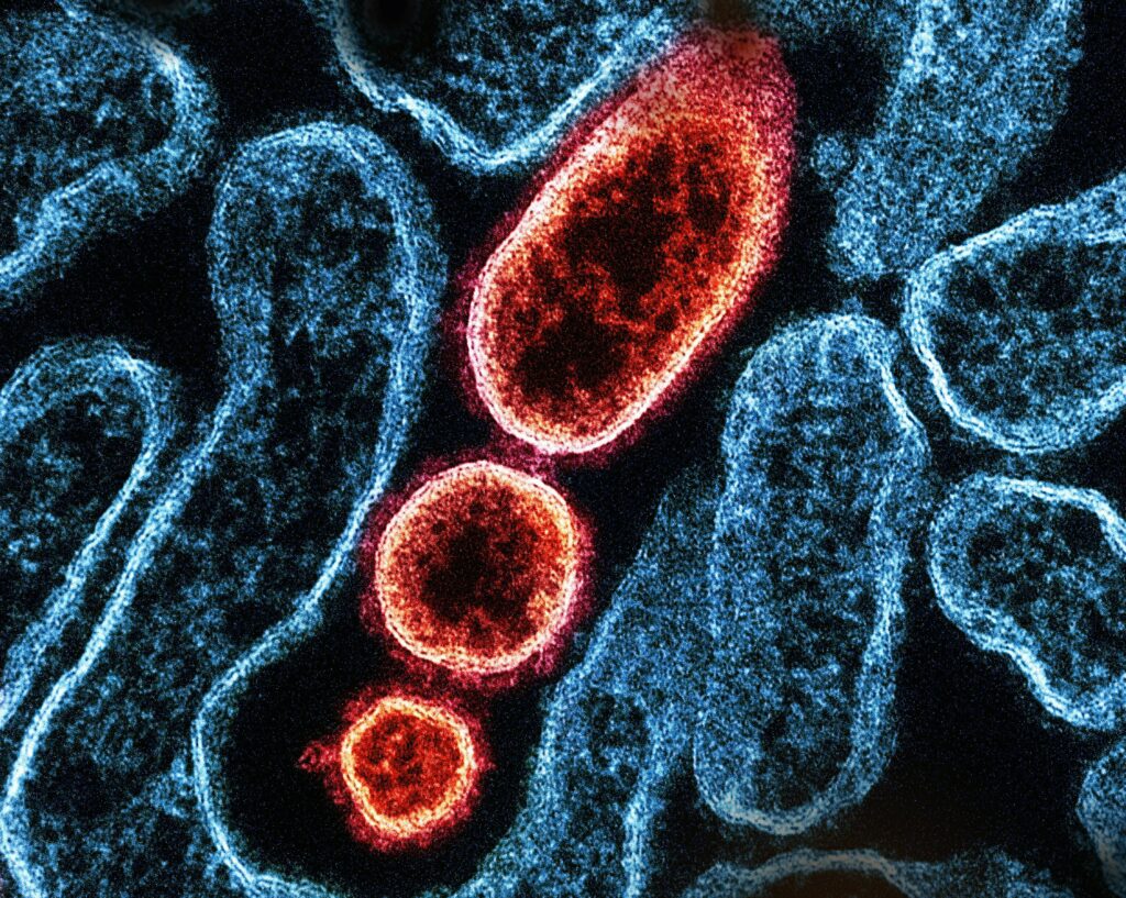 ce-este-virusul-nipah-si-de-ce-autoritatile-se-tem-de-o-epidemie
