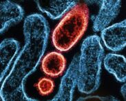 controale-amanuntite-in-aeroporturi-din-asia-dupa-ce-india-anunta-noi-infectii-cu-virusul-nipah