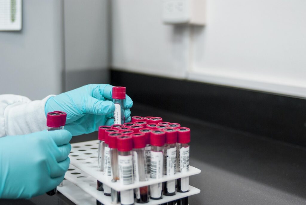 un-test-de-sange-ar-putea-depista-boala-parkinson-cu-ani-inainte-de-aparitia-simptomelor