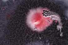 o-bacterie-comuna-in-ochi-ar-putea-provoca-alzheimer