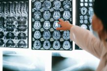 covidul-de-lunga-durata-ar-putea-declansa-modificari-cerebrale-similare-cu-alzheimer,-arata-un-nou-studiu