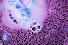 13-milioane-de-bolnavi-in-2024-si-un-singur-antibiotic-ramas-eficient.-o-boala-face-ravagii