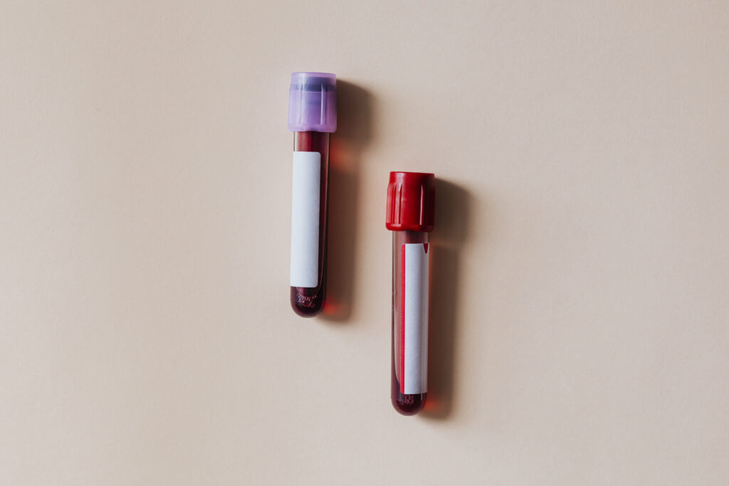 un-test-de-sange-detecteaza-50-de-tipuri-de-cancer-inainte-sa-apara-simptomele