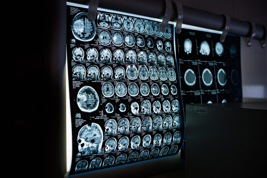 surpriza-uriasa-a-unui-pacient-in-varsta-de-31-de-ani:-a-aflat-ca-are-un-organ-intern-in-plus