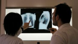 insp:-romania-continua-sa-inregistreze-cea-mai-ridicata-rata-a-incidentei-tuberculozei-din-ue-/-tristele-date-ale-zilei-mondiale-a-tuberculozei