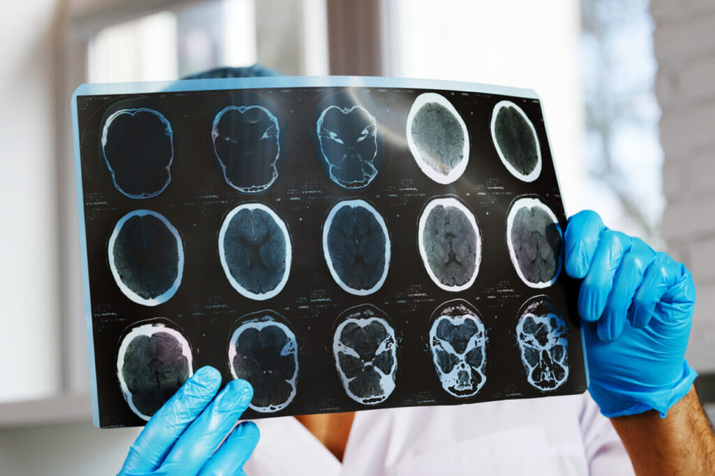 neurologii-vorbesc-despre-cel-mai-bun-obicei-pentru-mentinerea-unei-memorii-bune-dupa-varsta-de-55-de-ani.-ce-ar-trebui-sa-faci-zilnic