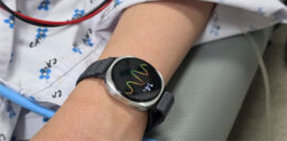 samsung-galaxy-watch-va-putea-prezice-episoadele-de-lesin,-alertand-utilizatorii-care-se-lovesc-de-aceasta-problema