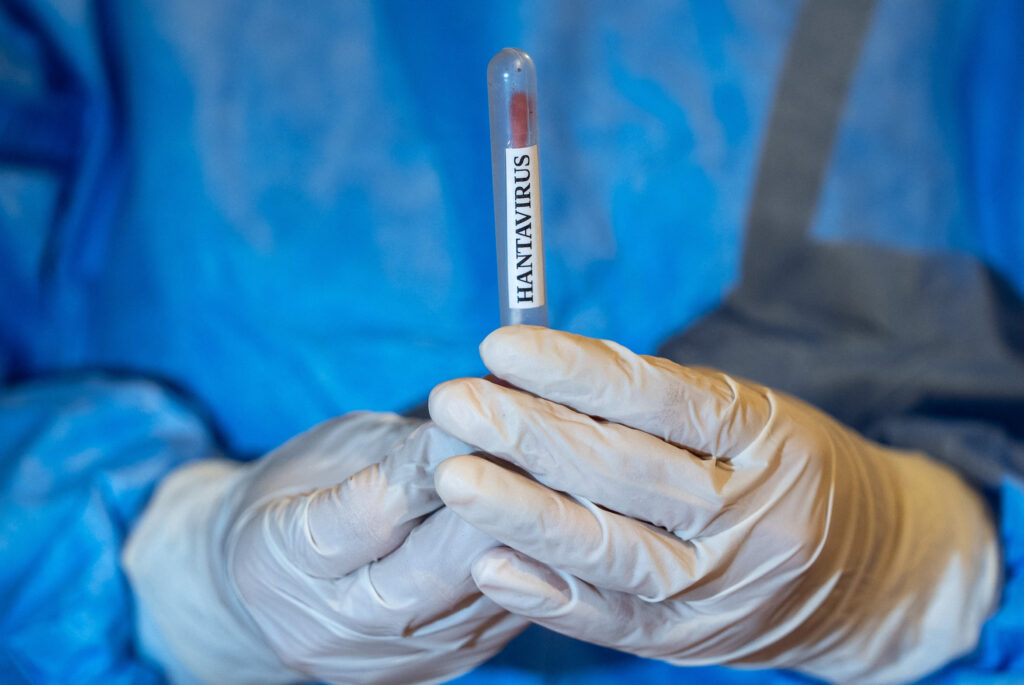 femeia-internata-intr-un-spital-din-alicante-din-cauza-suspiciunii-de-hantavirus-a-iesit-negativa-la-testul-pcr.-ce-urmeaza