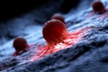 in-sua,-a-fost-creat-un-vaccin-personalizat-impotriva-cancerului-cerebral,-anunta-universitatea-washington