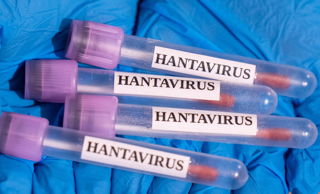 medicul-adrian-marinescu,-despre-cazul-de-hantavirus-de-la-arad:-nu-se-pune-problema-de-transmitere-de-la-om-la-om