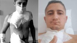 adrian-oprea,-un-tanar-cu-lupus,-se-lupta-sa-duca-o-viata-normala-dupa-ce-rinichiul-i-a-cedat-la-doar-doua-zile-dupa-transplant.-mi-am-pierdut-speranta