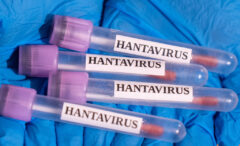 femeia-franceza-infectata-cu-hantavirus-ramane-in-stare-grava-la-terapie-intensiva