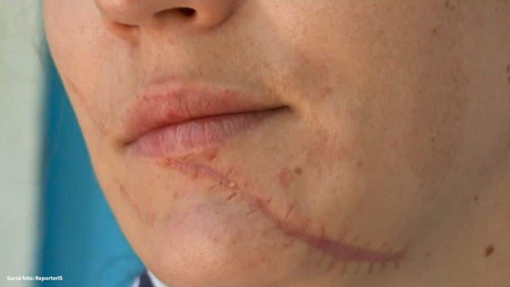 si-a-mutilat-sotia,-care-risca-sa-ramana-cu-cicatrici!-a-batut-o-cu-pumnii-si-picioarele,-apoi-a-taiat-o!