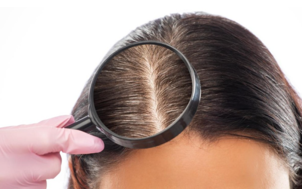 ce-defineste-un-sampon-antimatreata-bun-pentru-par-si-scalp?-(p)