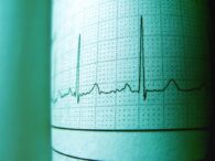 recomandarea-neasteptata-a-cardiologilor-pentru-protectia-inimii.-ce-aliment-trebuie-consumat-de-doua-ori-pe-saptamana