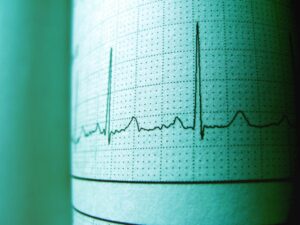 recomandarea-neasteptata-a-cardiologilor-pentru-protectia-inimii.-ce-aliment-trebuie-consumat-de-doua-ori-pe-saptamana