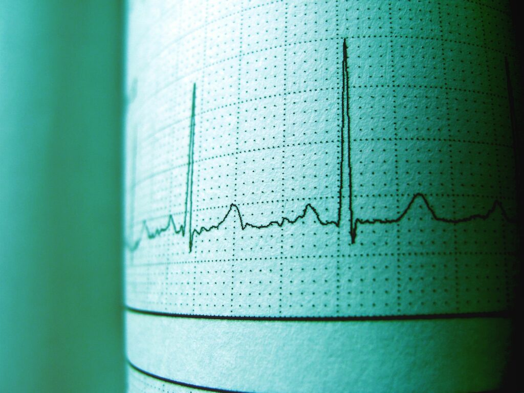 recomandarea-neasteptata-a-cardiologilor-pentru-protectia-inimii.-ce-aliment-trebuie-consumat-de-doua-ori-pe-saptamana
